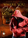 Where You Hurt the Most (eBook)